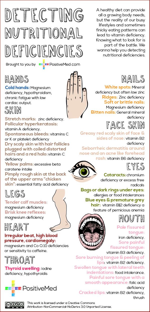 detecting nutritional deficiencies